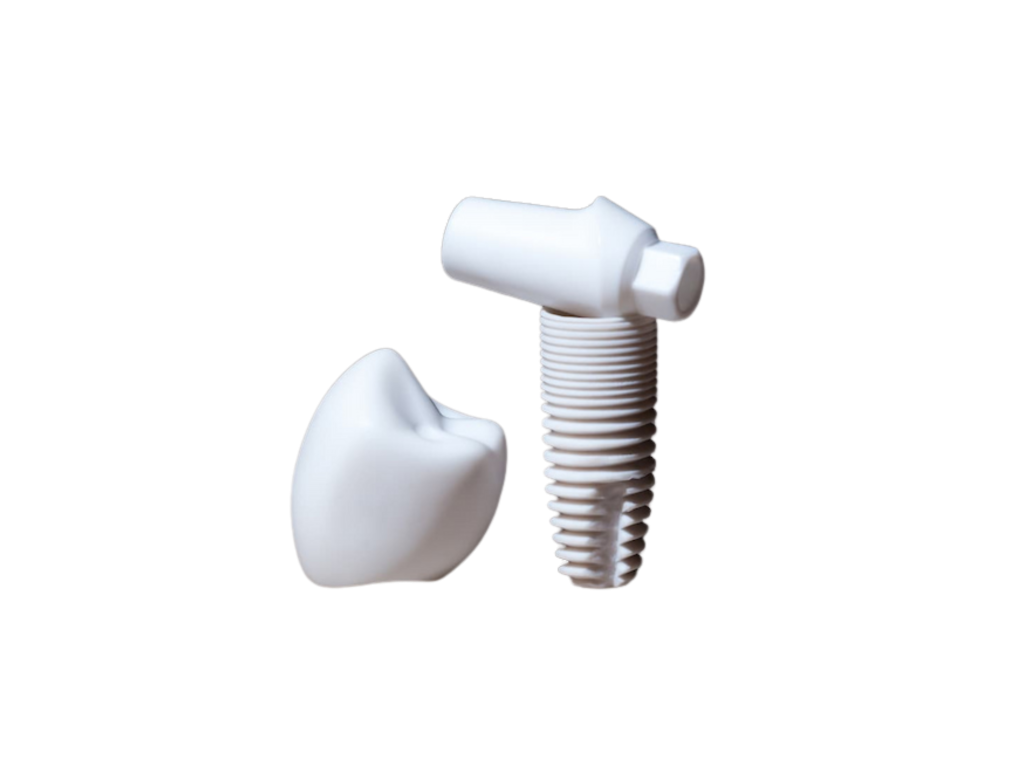 A close-up model of a titanium dental implant with a crown placed beside it, showing the screw design and abutment structure.