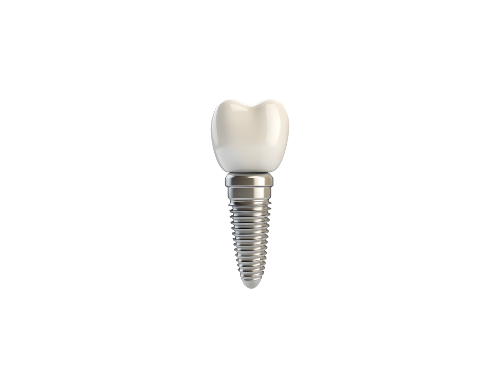 A single zirconia dental implant with a tooth-colored crown and ceramic screw design.