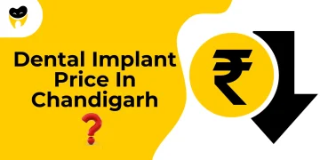 Dental Implant Price In Chandigarh: Cost Breakdown & Affordable Options