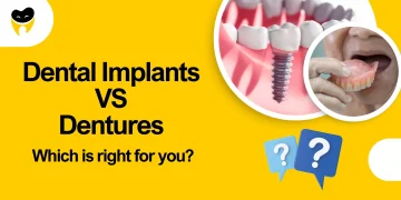 Dental Implants vs. Dentures: Which Is Right for You?