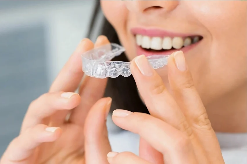 Invisible Braces In Chandigarh​