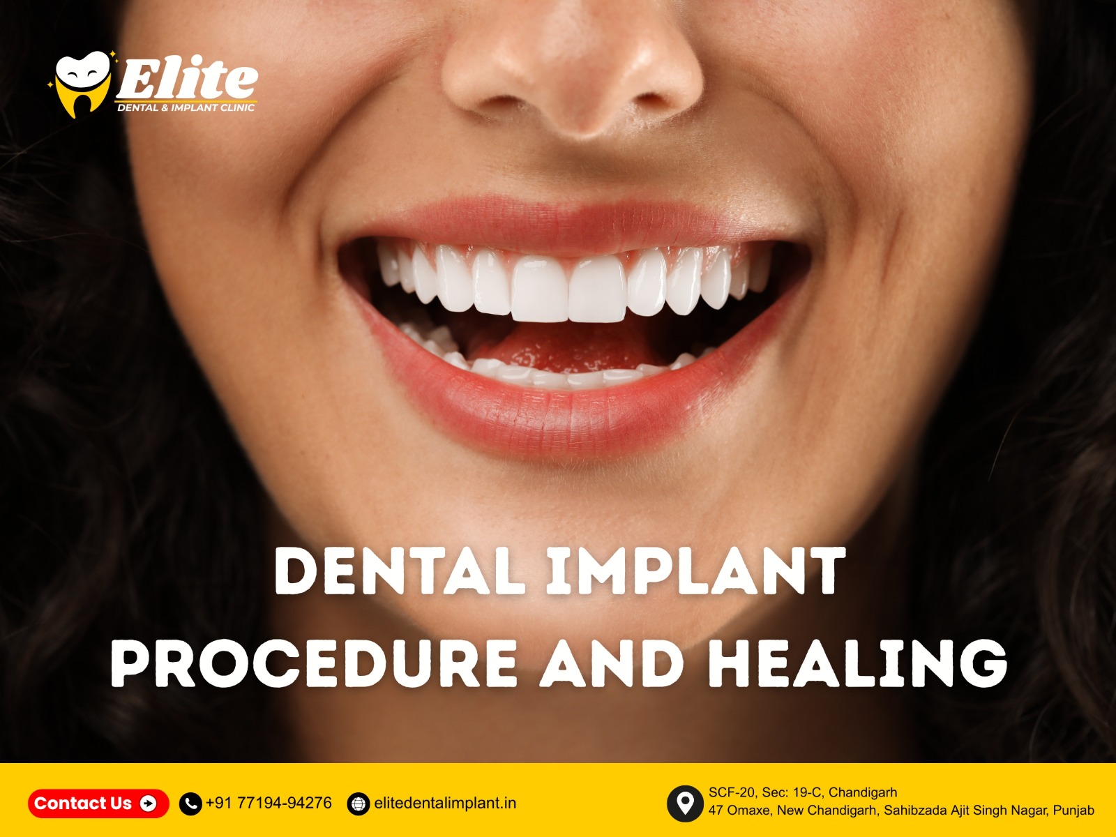 Woman smiling with restored teeth after dental implant procedure at Elite Dental and Implant Clinic in Chandigarh