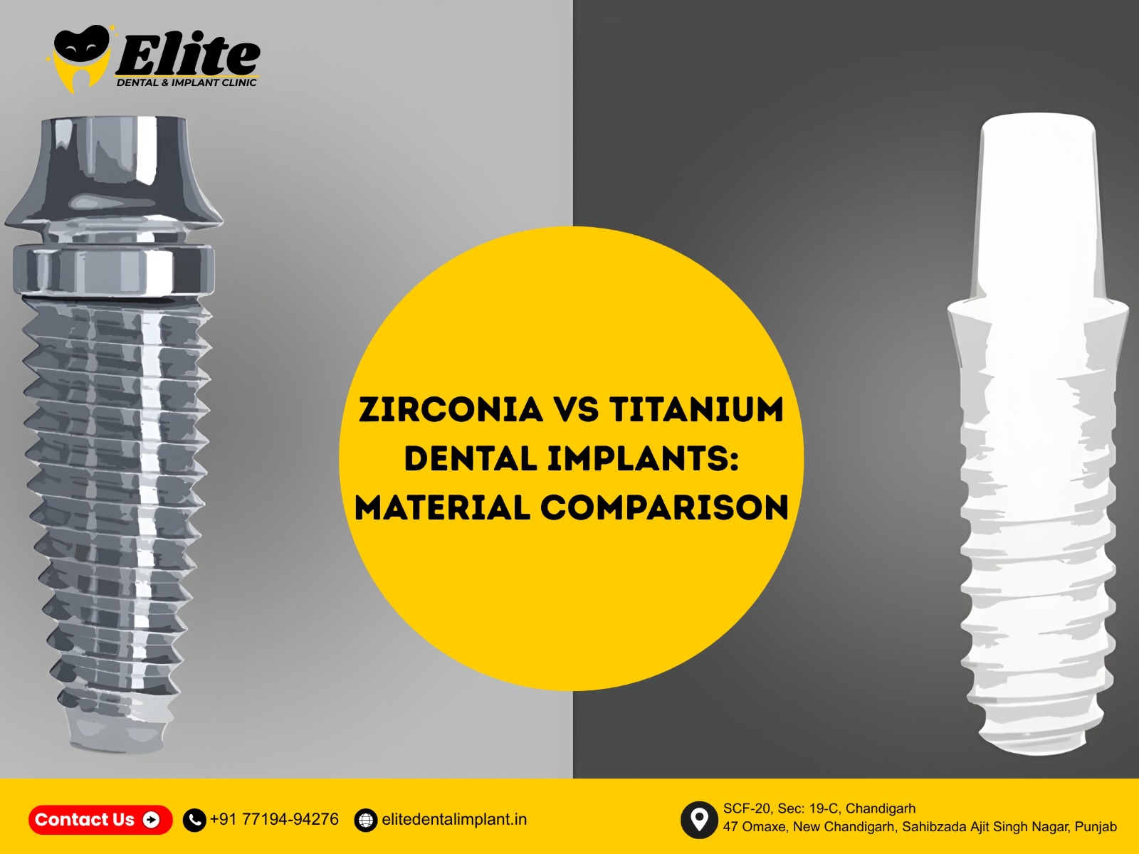 Zirconia and titanium dental implant comparison showing material differences at Elite Dental & Implant Clinic.