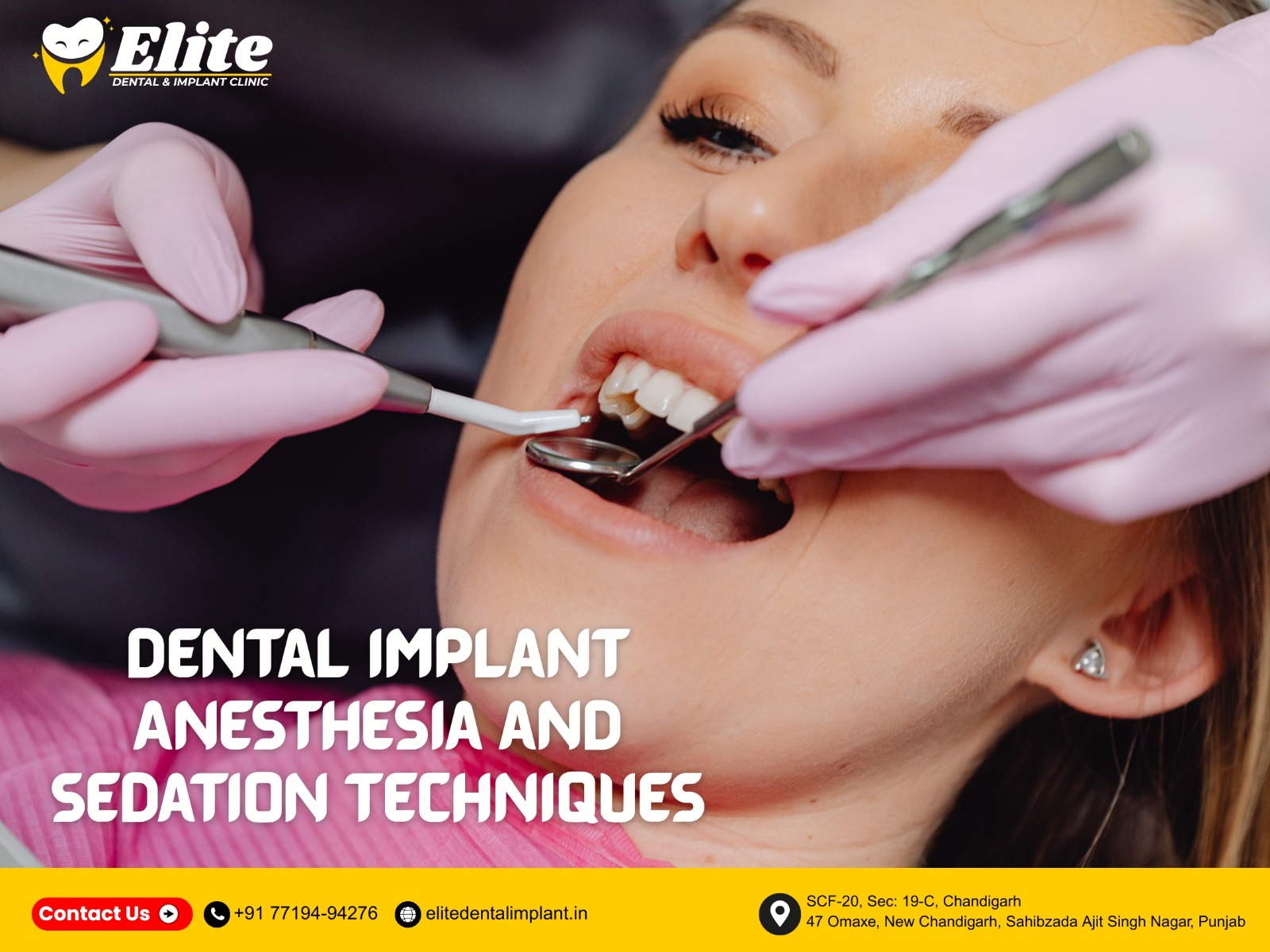 Patient undergoing dental implant procedure with anesthesia and sedation techniques at Elite Dental & Implant Clinic.