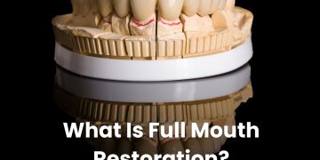 What Is Full Mouth Restoration?