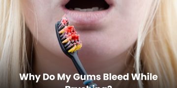 Why Do My Gums Bleed While Brushing?